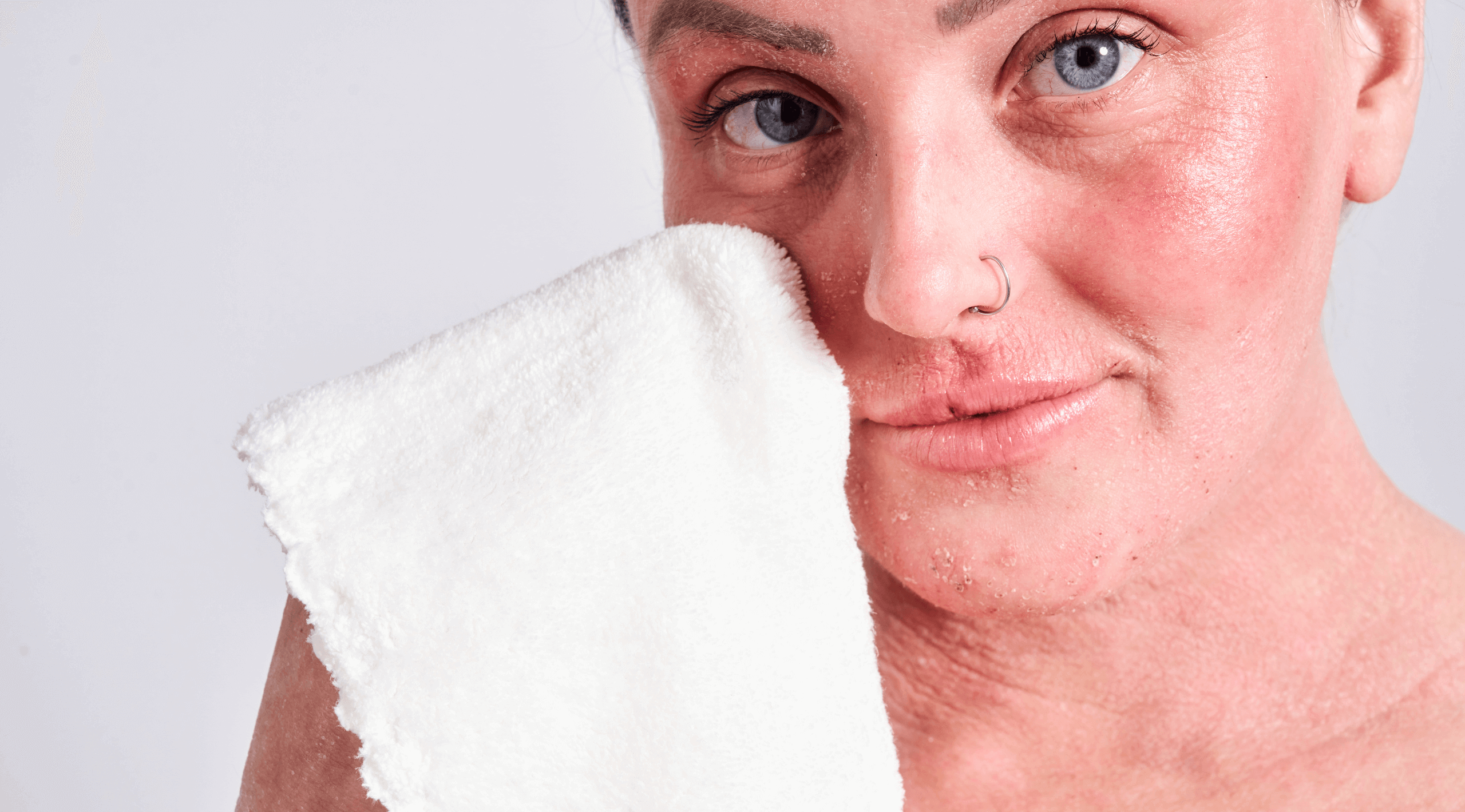 Is fragrance in skincare bad for eczema?