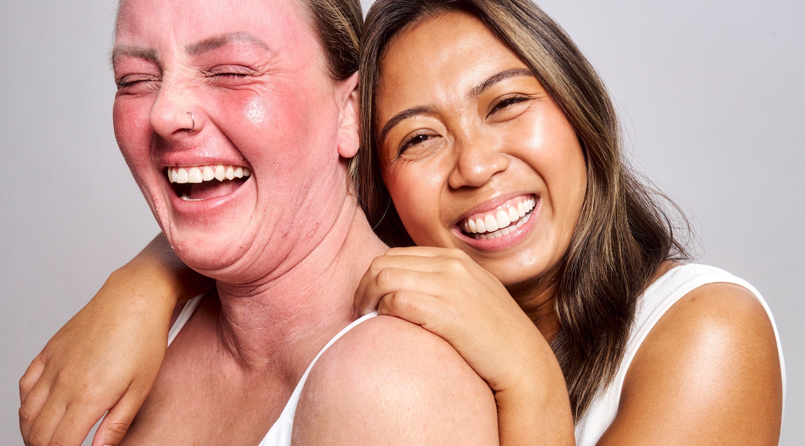 What Is eczema? Symptoms, causes and how to manage it