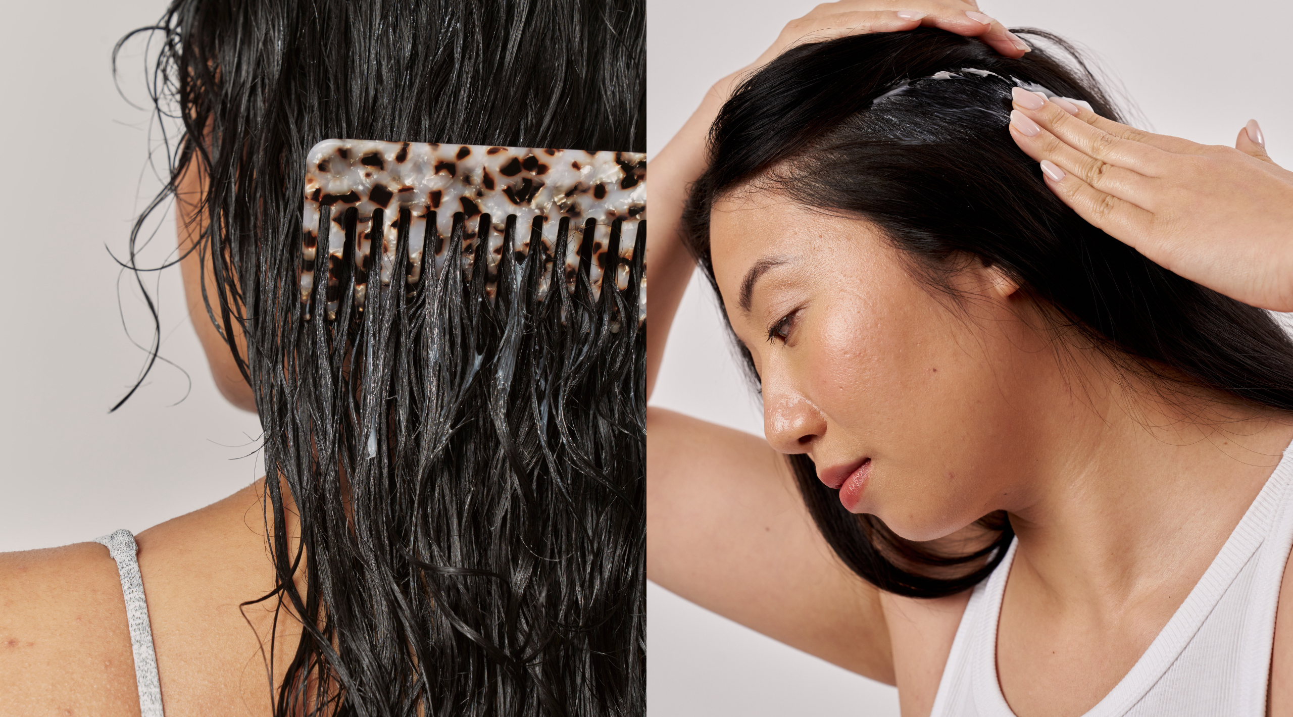 Can stress make your scalp flaky?