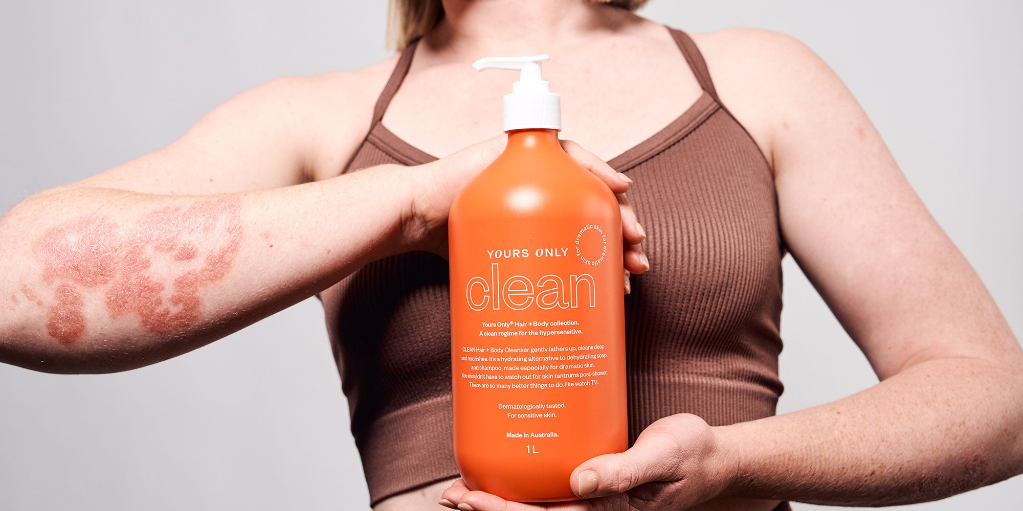 Woman holding Yours Only Clean Hair + Body Cleanser, showing arm with skin condition