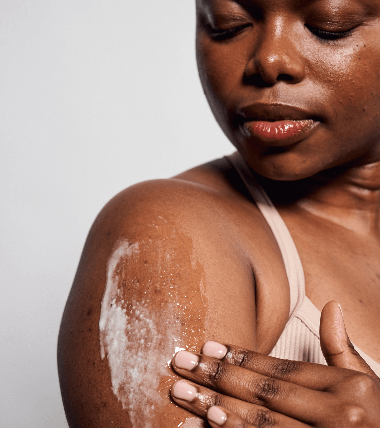 Woman with a visible skin condition on her arm against a plain background