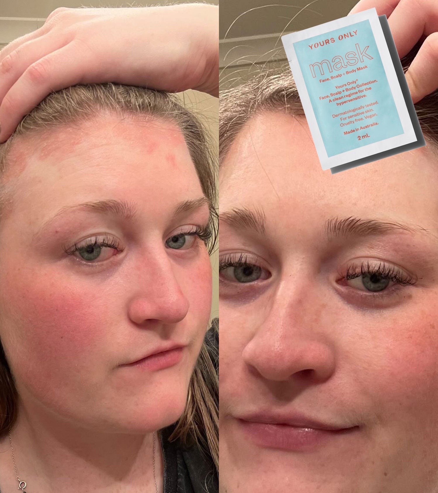 patch test sample set