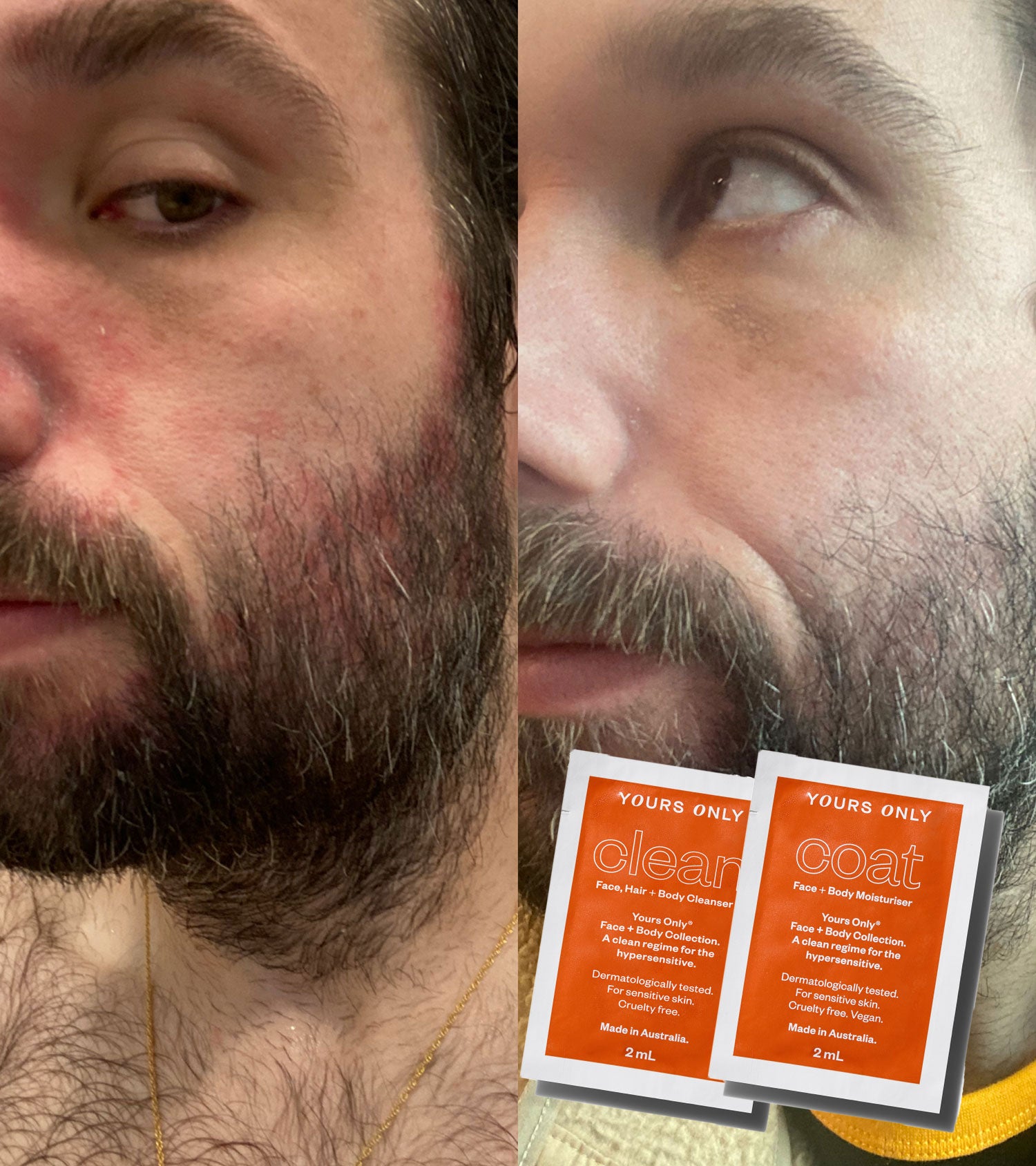 patch test sample set