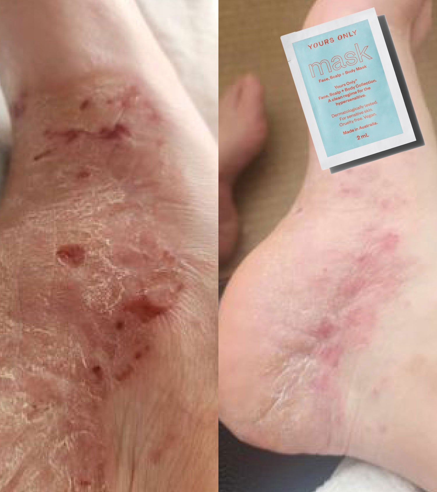 patch test sample set