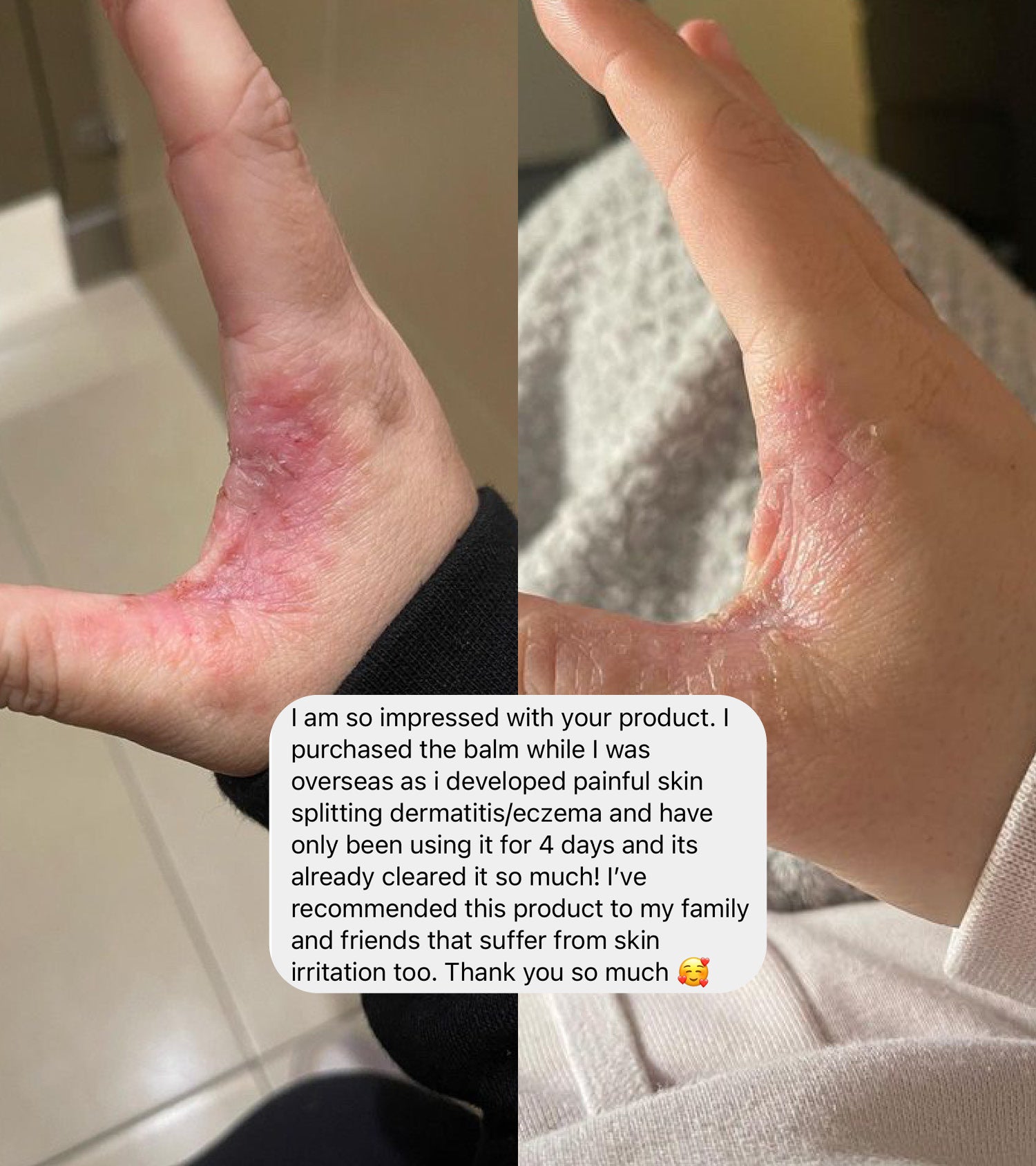 2 x balm 100g