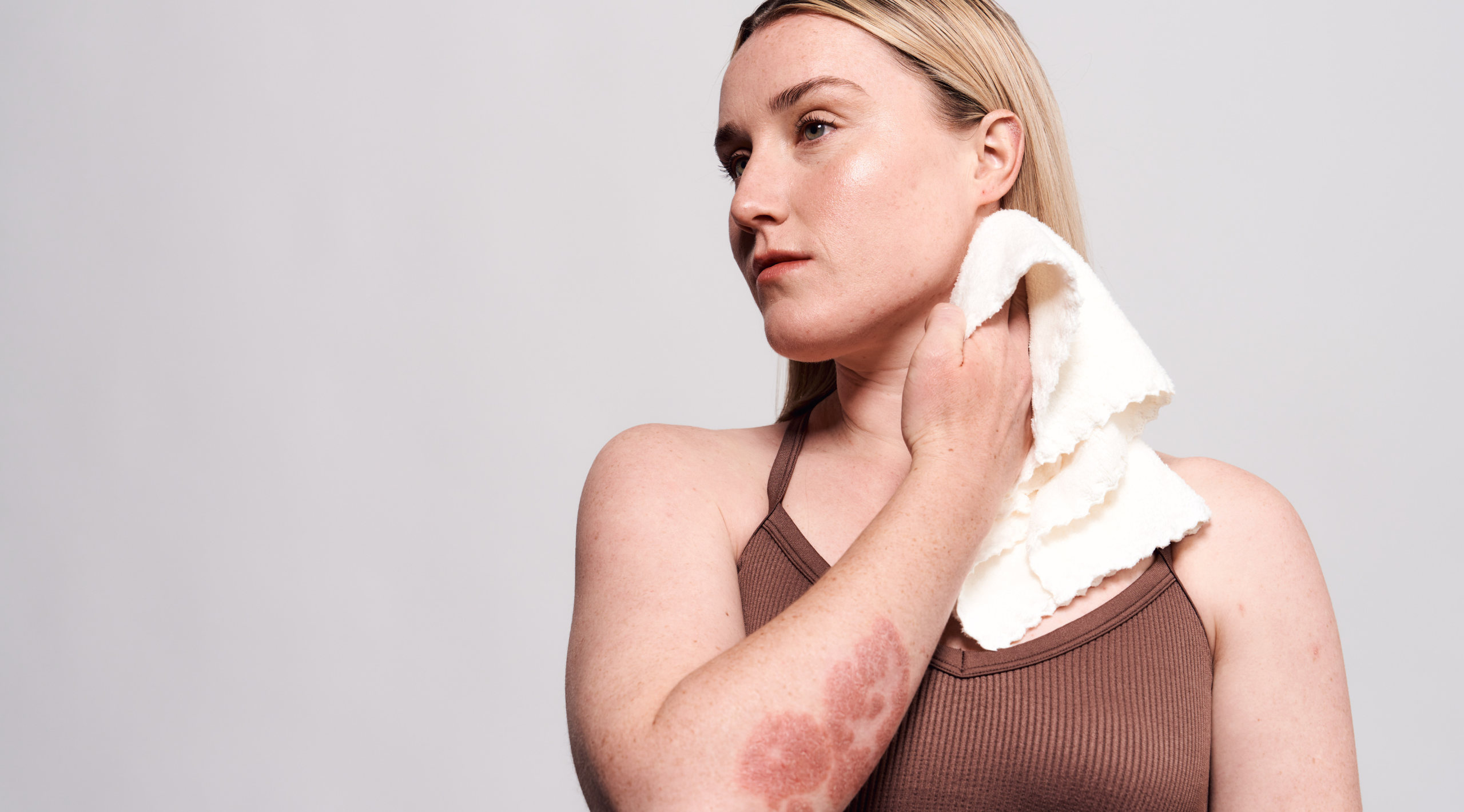 Can indoor heating make eczema worse? What you need to know