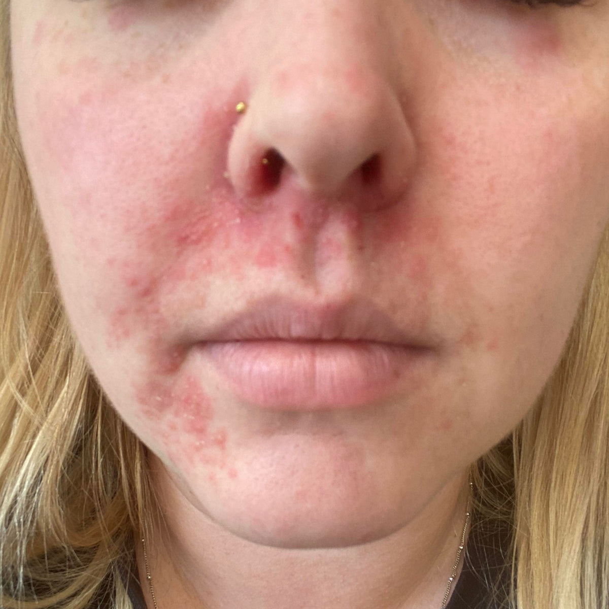 Day 1