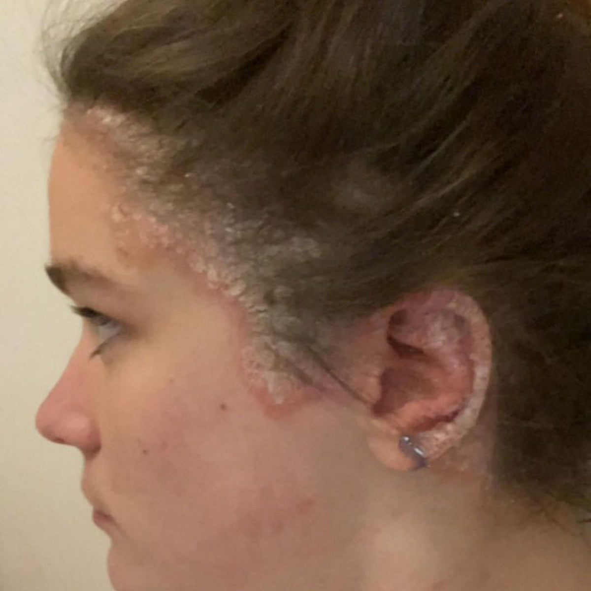 Day 1