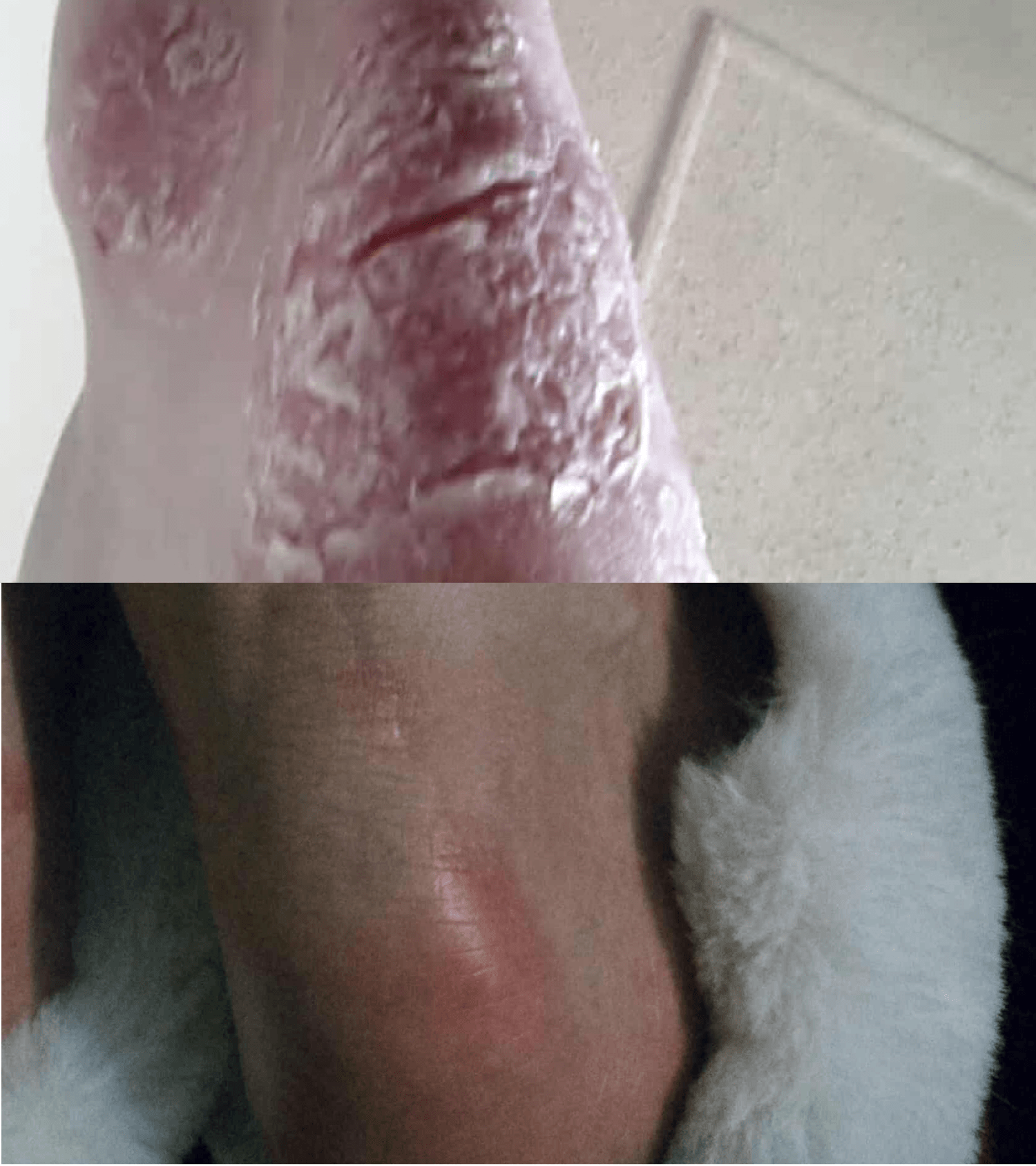 dry feet + heel bundle